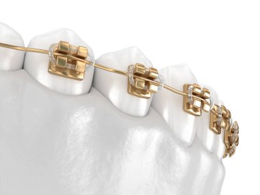 Altın telli sağlıklı dişler, beyaz stili konsept, 3 boyutlu diş tasviri