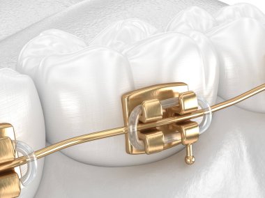 Altın telli sağlıklı dişler, beyaz stili konsept, 3 boyutlu diş tasviri