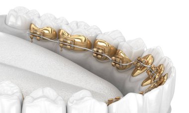 Dil telleri sistemi. Altın diş tellerinin 3D illüstrasyon konsepti