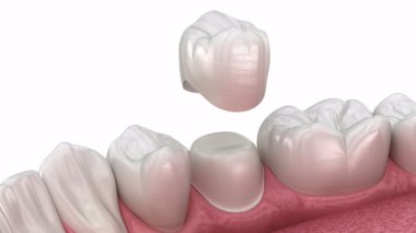 Dişlerin üzerine diş macunu yerleştirilmiş. Diş 3B canlandırması