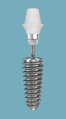Diş implantı. 3 Boyutlu Canlandırma