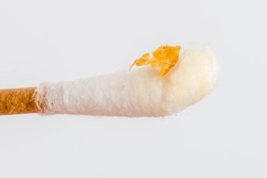 Kulak kiri ile pamuk çubuğu. Kulağı temizledikten sonra kulak kiri.