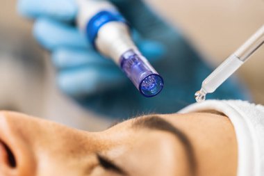Kozmetikçi, kozmetik salonlarında dermapen kullanan hastalarla ilgilenir.. 
