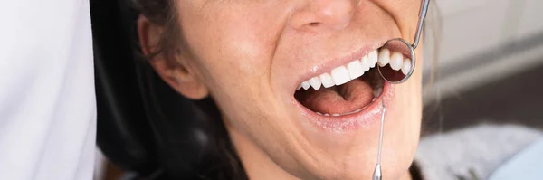 Улыбающаяся Красавица Которой Клинике Зубной Врач Осмотрел Зубы Размер Баннера — стоковое фото