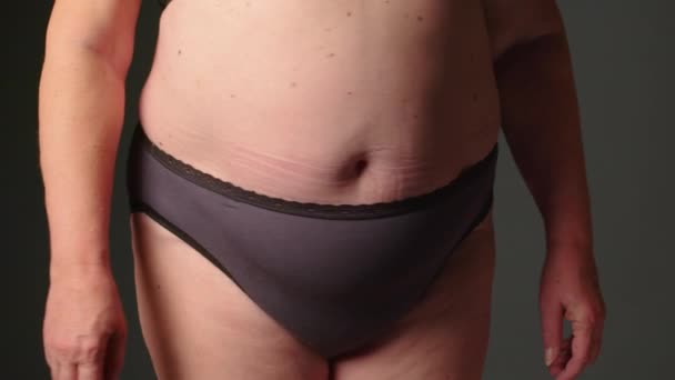 腹部肥胖的女人老年妇女肥胖 肥胖的女性腹部 女人拿着皮肤检查脂肪 腹部肥大的皮肤 灰色背景下的整形外科概念 高质量的4K镜头 — 图库视频影像