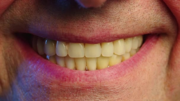 Egy Idős Férfi Közeli Mosolya Műfogsorral Parodontális Betegség Hiányzó Fogak — Stock videók