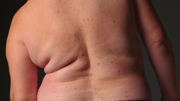 Cerca Espalda Mujer Gorda Mujer Dobla Lado Pliegues Piel Grasa — Vídeos de Stock