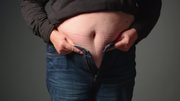 Primer Plano Mujer Gorda Pliegues Piel Grasa Estómago Pérdida Peso — Vídeo de stock