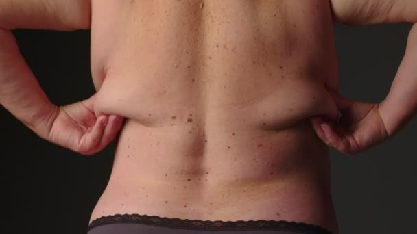 Близько Товстої Жінки Жінка Нахиляється Сторону Складається Шкіри Жиру Спині — стокове відео
