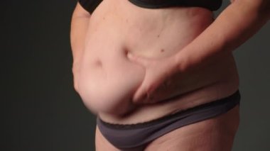 Göbek yağlı kadın. Yaşlı kadınlarda obezite. Şişman kadın göbeği, selülitleri kontrol etmek için deriyi tutan kadın. Şişman bir karında sarkık deri, gri arka planda plastik cerrahi konsepti. Yüksek kalite 4k görüntü