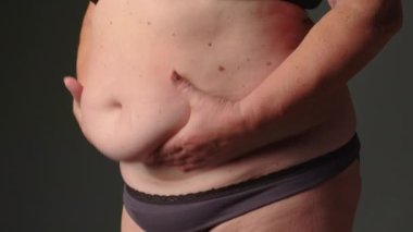 Aşırı kilolu yaşlı bir kadın göbeğini çimdikliyor, aşırı yemek yiyor, obezite yaşıyor. Kilolu insanların vücudunda normalden daha fazla yağ olması, vücut kitle indeksi, sağlıksız bir kavram. Yüksek kalite 4k görüntü