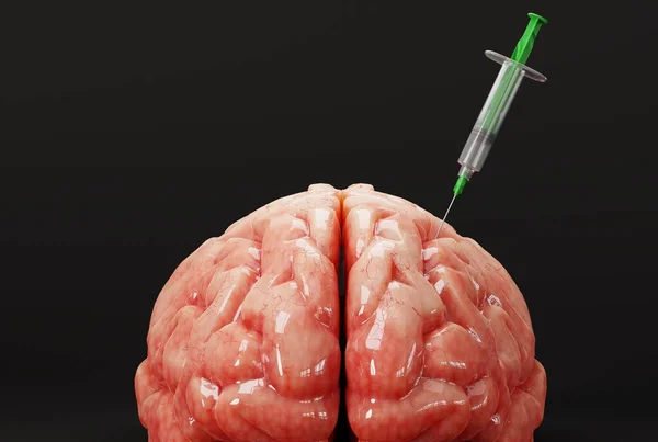 Syringe stuck in the brain. Concept of injecting a substance into the brain, injecting something. Improving functioning of the brain, drugs to improve mental condition. 3D render.