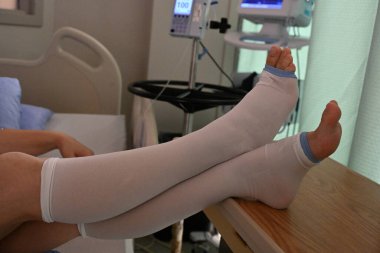 Ameliyat için tıbbi sıkıştırma çorapları