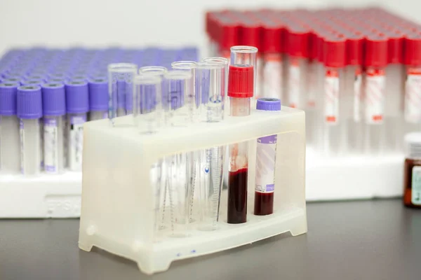 medical test tubes stand on the table with blood tests, close-up