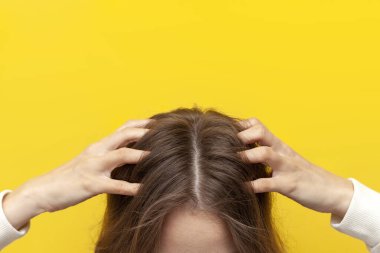 Kiz saçlarini ve kafasini kepek ve cilt problemleri için elleriyle ciziyor, kafasini parmaklariyla kapatiyor.