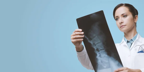 Radiologista Feminina Confiante Verificando Imagem Radiológica Coluna Vertebral — Fotografia de Stock