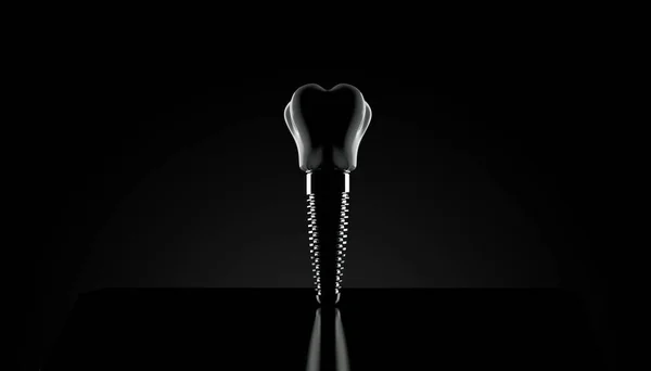 Implants Dentaires Sur Fond Noir Illustration — Photo