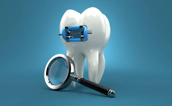 Zahn Mit Zahnspange Und Lupe Auf Blauem Hintergrund Illustration — Stockfoto