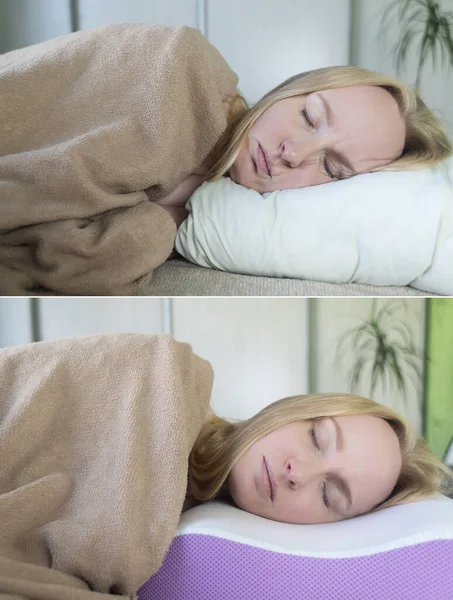 Before and after. On one frame, mimic folds from the wrong pillow. There are no wrinkles in the other photo, as an orthopedic pillow is used. Cosmetology and dermatology