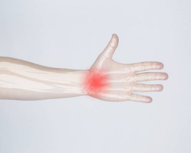 Romatoid eklem iltihabı. Kemiklerin röntgeni bir adamın fotoğrafına yerleştirilmiş. Parmaklarda ve parmak kemiklerinde hastalıklar. Kemik dokularındaki iltihaplı süreçlerin tedavisi ve teşhisi
