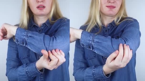 Πριν Και Μετά Πόνος Αγκώνα Κορίτσι Παρουσιάζει Συνέπειες Τραυματισμού Του — Αρχείο Βίντεο