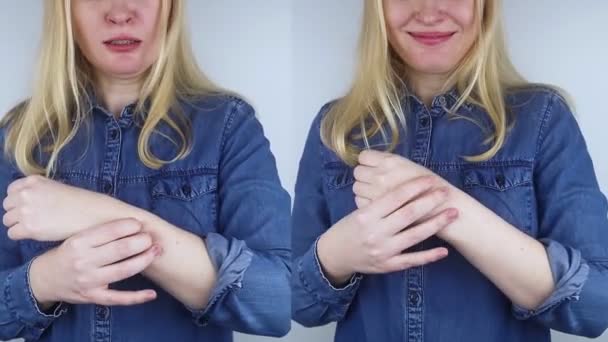 Antes Depois Mulher Esquerda Atormentada Pela Dor Braço Mão Dedos — Vídeo de Stock
