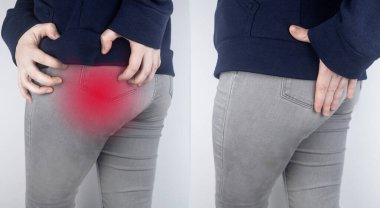 Önce ve sonra. Bir kadın kalça ağrısından muzdariptir. Doktor hastaya piriforis sendromu, siyatik sinir, bel osteokondrosis ya da siyatik teşhisi koyuyor.