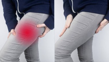 Before and after. On left, a woman has acute pain in the hip after a muscle strain or tear. On right, doctors have healed and the muscles of the thigh are no longer disturbed. Bone fracture clipart