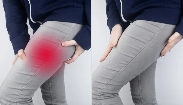 Before and after. On left, a woman has acute pain in the hip after a muscle strain or tear. On right, doctors have healed and the muscles of the thigh are no longer disturbed. Bone fracture
