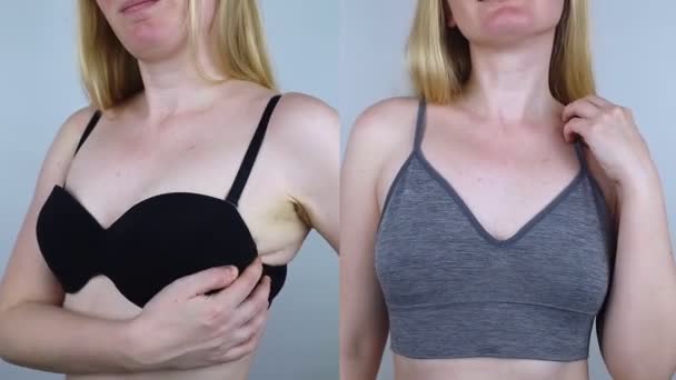Före Och Efter Obekväm Behå Märken Icke Anatomiska Underkläder Som — Stockvideo
