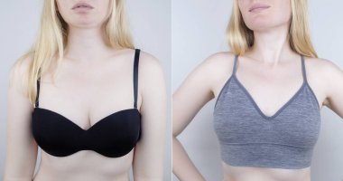 Önce ve sonra. Rahatsız edici sutyen. Sütyen izleri. Meme bezlerinin sıkışmasına ve ovulmasına neden olan anatomik olmayan iç çamaşırı. Mastofati ve mastalji. Kadınlar münasip olanı seçer ve bir kenara atılırlar.