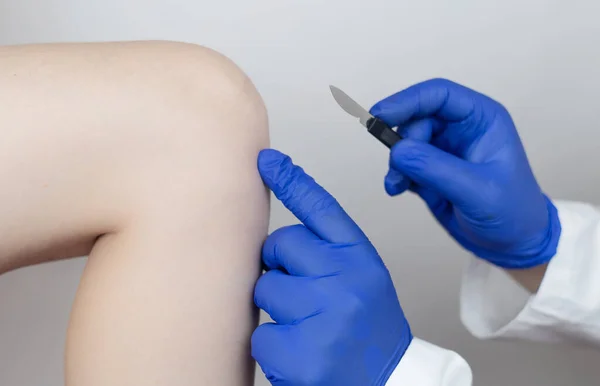 Cirurgia Joelho Cirurgião Ortopédico Mostra Paciente Onde Incisão Será Feita — Fotografia de Stock