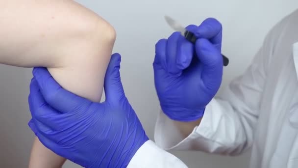 Chirurgie Coude Chirurgien Montre Patient Sera Incision Avec Scalpel Pour — Video