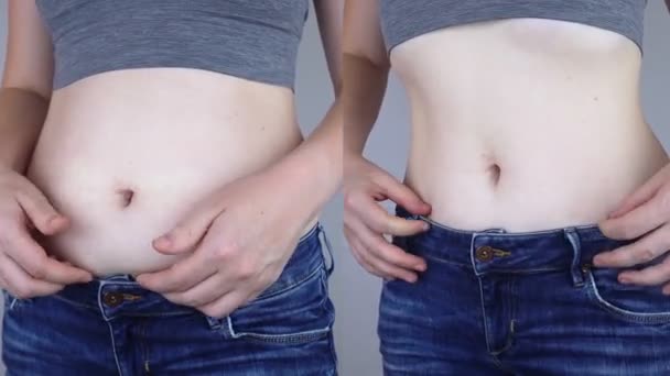 Obezita Celulitida Záhyby Přebytečného Tuku Ženském Pasu Předtím Potom Koncept — Stock video