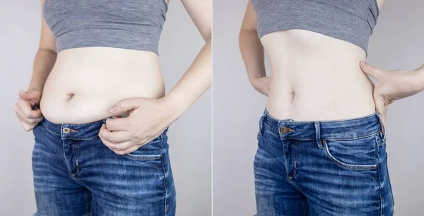 Obesity Cellulite Folds Excess Fat Woman Waist Concept Losing Weight — Stock Photo, Image