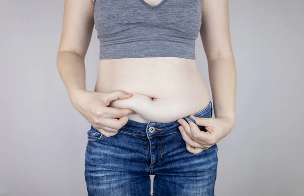 Ожиріння Целюліт Складки Зайвого Жиру Жіночій Талії Після Концепція Схуднення Ліцензійні Стокові Зображення