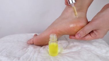 Topukları çatlamış. Sert cildi yumuşatmak için prosedürlerden önce ve sonra kadın ayakları. Urea kremi, keratinli cilt bakımı için yağ, kırık ayakların iyileşmesi. Ayak rendesi, ürealı krem, yumuşatıcı yağ..