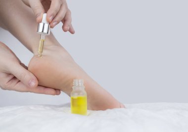 Topukları çatlamış. Sert cildi yumuşatmak için prosedürlerden önce ve sonra kadın ayakları. Urea kremi, keratinli cilt bakımı için yağ, kırık ayakların iyileşmesi. Ayak rendesi, ürealı krem, yumuşatıcı yağ..