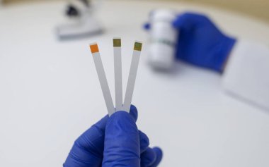 Bakteriyel Vajinoz. Vajinal pH. Teşhis edildi. Asitin normal olup olmadığını ölçebileceğiniz ölçek. Renklerle gösterilen normal asit seviyesi standart ile karşılaştırılmalıdır. Laboratuvar ve ev