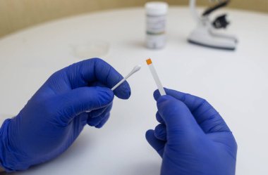 Bakteriyel Vajinoz. Vajinal pH. Teşhis edildi. Asitin normal olup olmadığını ölçebileceğiniz ölçek. Renklerle gösterilen normal asit seviyesi standart ile karşılaştırılmalıdır. Laboratuvar ve ev