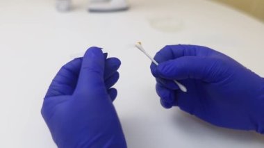 Bakteriyel Vajinoz. Vajinal pH. Teşhis edildi. Asitin normal olup olmadığını ölçebileceğiniz ölçek. Renklerle gösterilen normal asit seviyesi standart ile karşılaştırılmalıdır. Laboratuvar ve ev