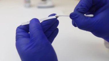 Bakteriyel Vajinoz. Vajinal pH. Teşhis edildi. Asitin normal olup olmadığını ölçebileceğiniz ölçek. Renklerle gösterilen normal asit seviyesi standart ile karşılaştırılmalıdır. Laboratuvar ve ev