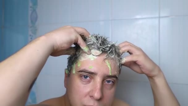 男人的确会擦头 黑头发的年轻人用头皮擦拭来对抗头皮屑 油性头皮 造成头发问题的皮肤问题 自动按摩和揉搓头发产品的特写 — 图库视频影像