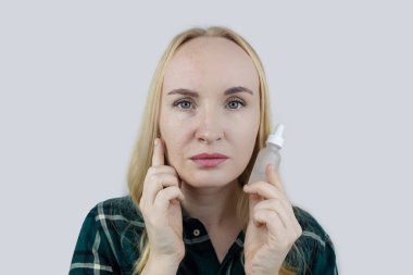 A vitamini, Retinol, Niacinamide, C vitamini kız yüzüne antioksidan kırışıklık önleyici krem sürüyor. Yaşlanma önleyici ve yüz tazeleme ajanı. Önce ve sonra. Görsel sonuç. Sivilce tedavisi