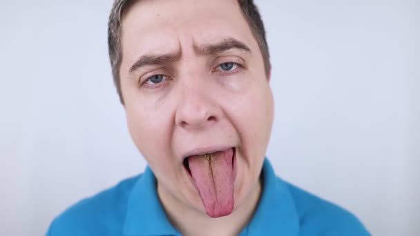 Raspador Língua Homem Mostra Placa Amarela Seguida Realiza Higiene Oral — Vídeo de Stock
