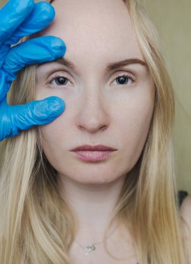 Mantarların ve genişlemiş göz bebeklerinin muayenesi. Bir doktor midriazi ve konaklama spazmı olan bir kadına göz muayenesi yapar. Zayıf görme ve göz kaslarında felç