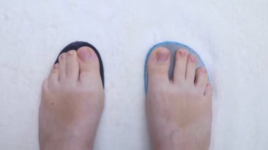 Ayağı deforme eden yanlış ayakkabı sunumu. Ayak tabanının küçük boyutu, bu da ayak ve valgusta ağrıya neden oluyor. Anatomik taban örneğinden sonra