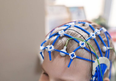 Bir çocuğun beyni EEG makinesinde incelenir. Elektroensefalogram nörolojik hastalıkların tespiti için bir hastane laboratuvarında yapılır. Çocuklar için ensefalogram