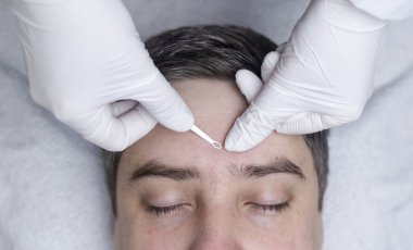 Yüz temizleme ve siyah başlık çıkarmadan geçen bir adam. Güzellik uzmanı komedi sökücü ya da uno ilmek kullanıyor. Güzellik salonunda profesyonel cilt bakımı