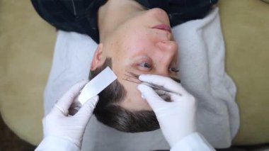 Bir dermatolog demodeks testi için erkek bir hastanın kaşlarını kazımak için cımbız kullanır. Dermatolojik inceleme ve deri parazitleri ve akarların teşhisi.